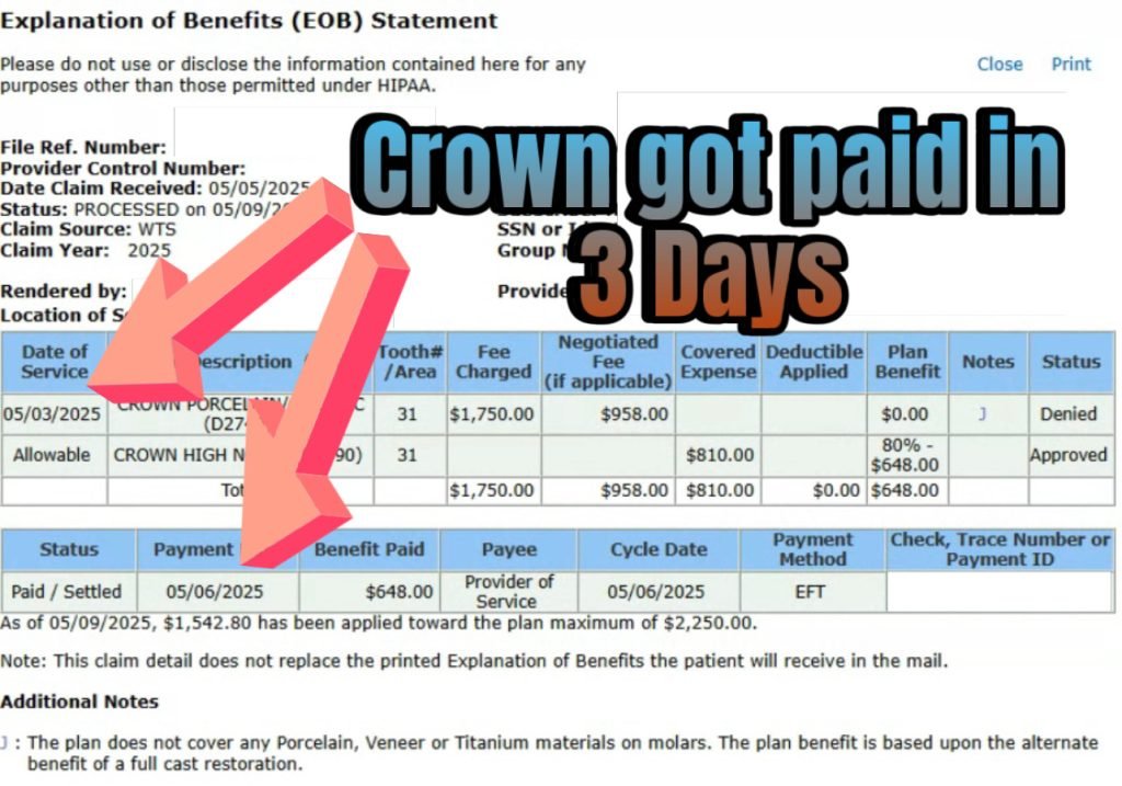 Dental Crown