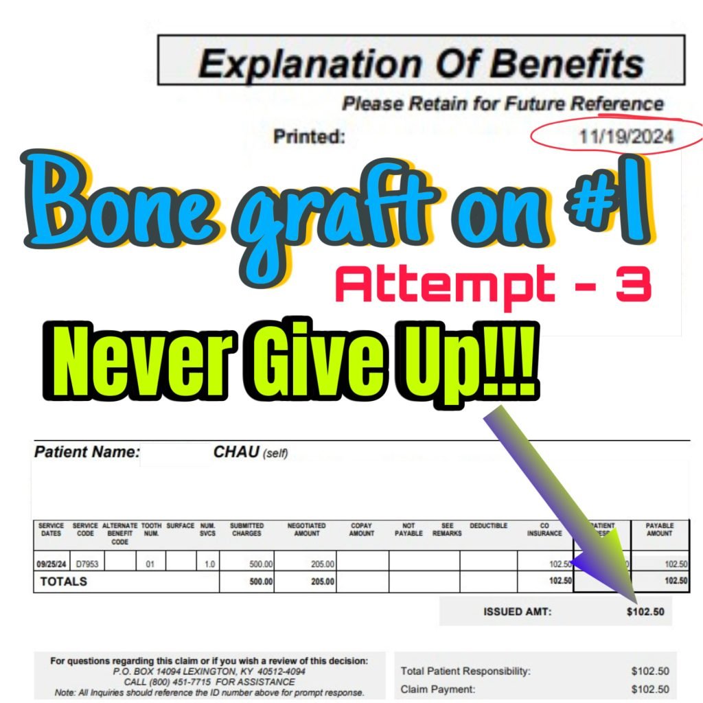 Bone Graft