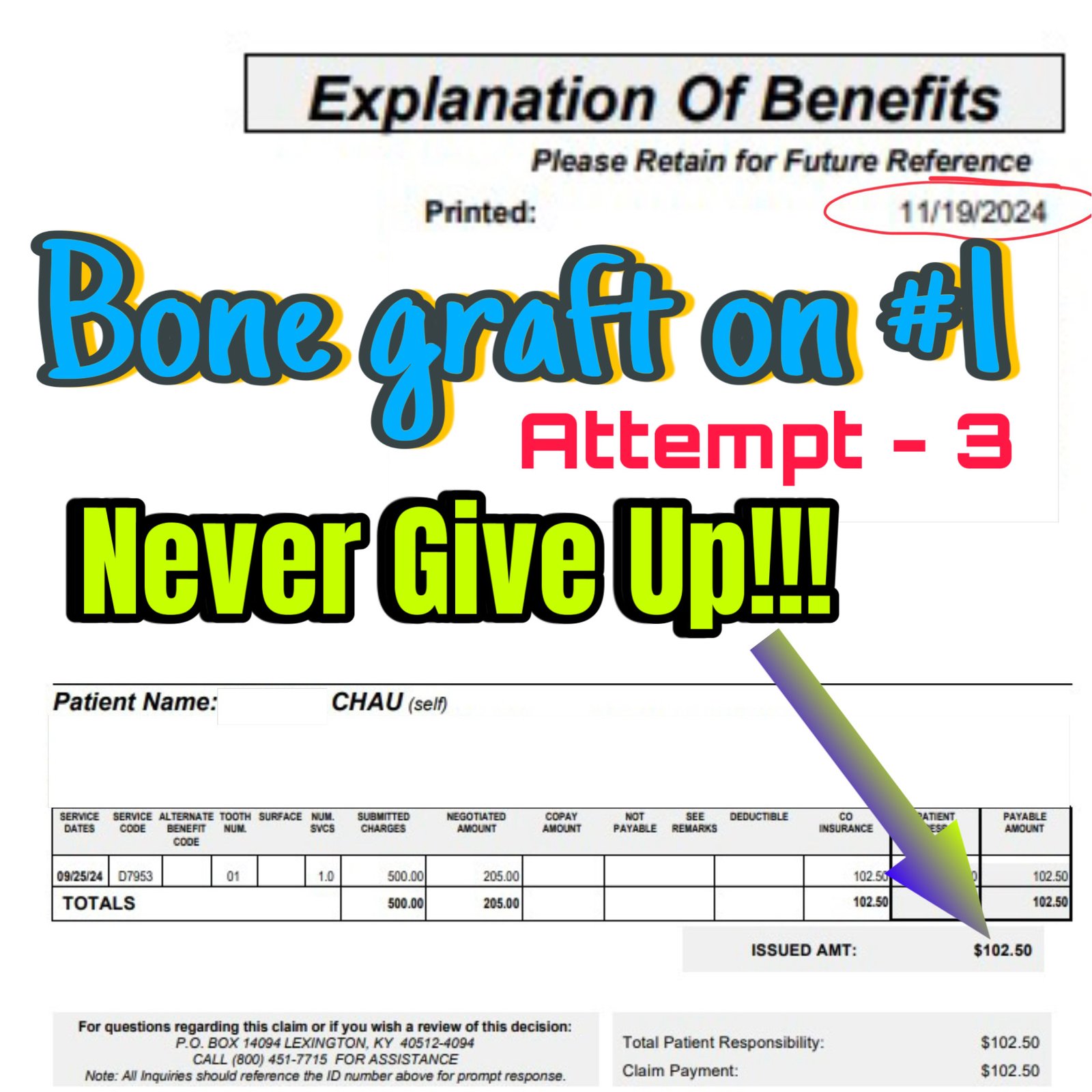 Bone Graft